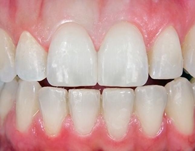 Case 2 after