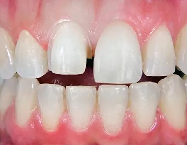 Case 2 before