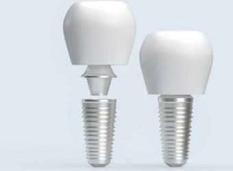 How Dental Implants Can Restore Your Smile and Improve Your Quality of Life